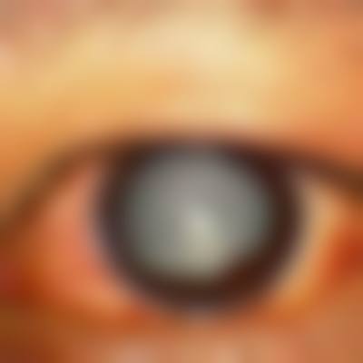 锡林郭勒盟中 心医院眼科——专精平台为眼健康护航