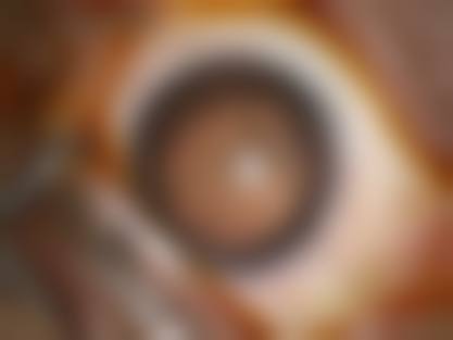 特色科室与项目:精细眼科诊疗,覆盖全年龄段