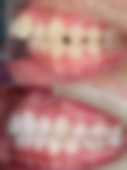 常见问题解答