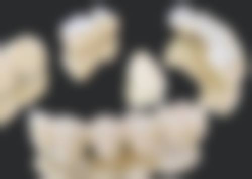 补牙次数与牙髓状态有关