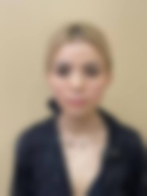 在广州珈禾找李勤医生做项目,价格贵不贵?(2026年参考)