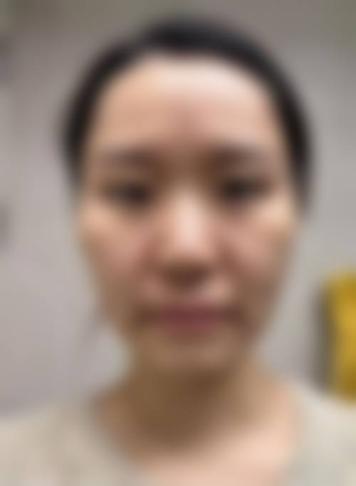 临沂安婷秀整形医疗美容的特色项目与技术优势