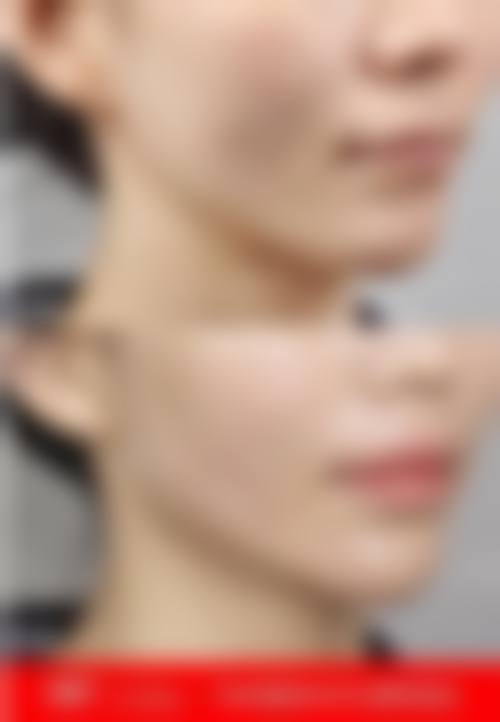 成都武侯塔娜纽菲妍医疗美容诊所2026年收费价格参考