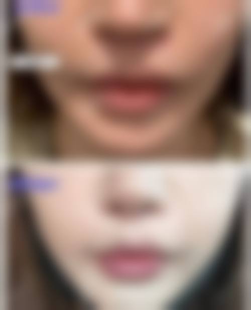 成都武侯塔娜纽菲妍医疗美容诊所的口碑好评:听听真实顾客怎么说
