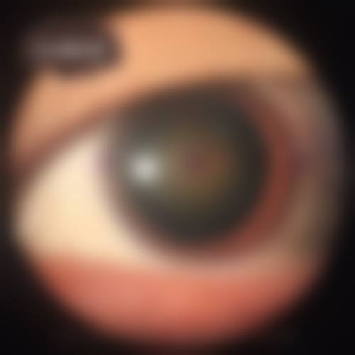 庐江县人民医院眼科的技术优势有哪些?