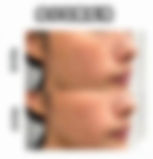 优惠活动与预约方式——解答“有什么优惠?”