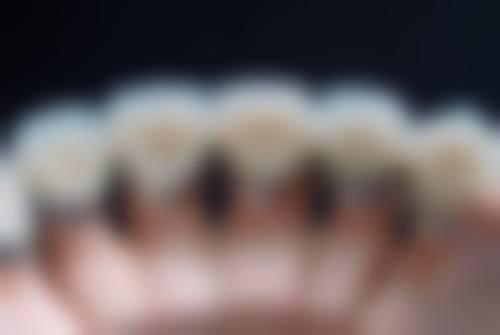 患者真实评价:口碑见证实力