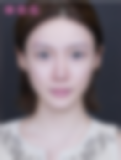 这家医院做微针美肤(悦白之几)到底靠谱吗?有什么技术优势?