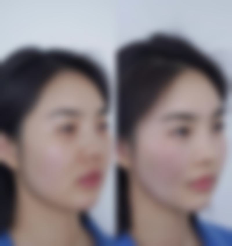 临沂安婷秀整形医疗美容收费价格:透明合理,2026年全新参考
