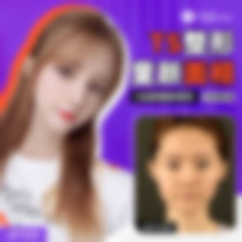 常见问题(FAQ)