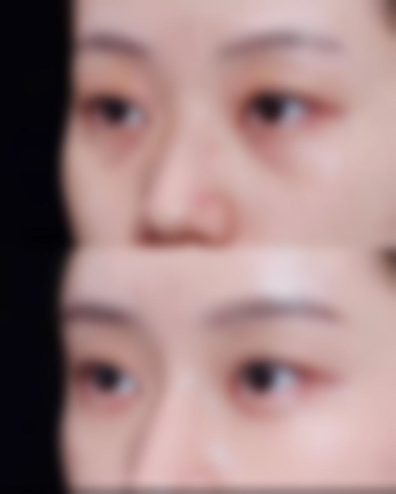 在广州珈禾,李勤医生主要擅长哪些项目?